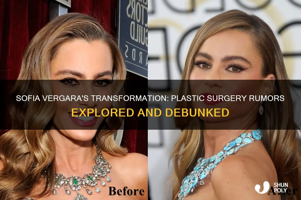 did sofia vegara get plastic surgery