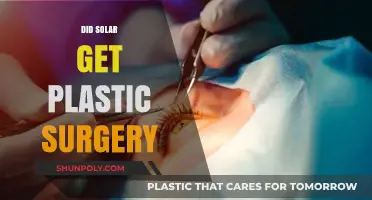 Did Solar Undergo Plastic Surgery? Unraveling the Truth Behind the Rumors