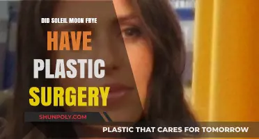 Soleil Moon Frye's Transformation: Plastic Surgery Rumors Explored