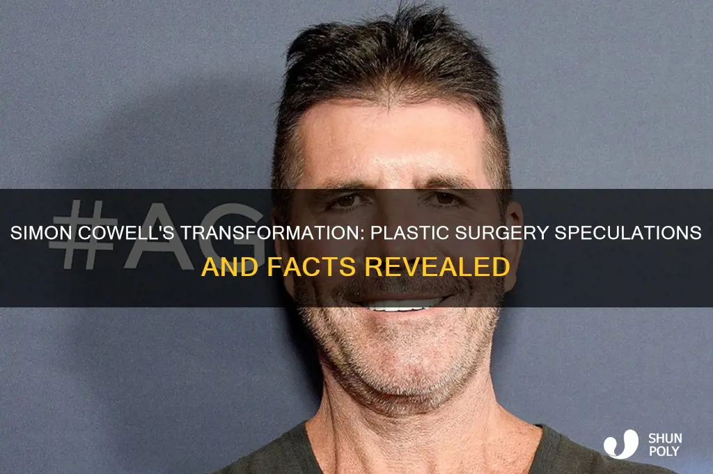 did somon cowell have plastic surgery