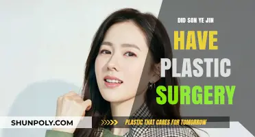 Son Ye Jin Plastic Surgery: Fact-Checking the Rumors and Speculations