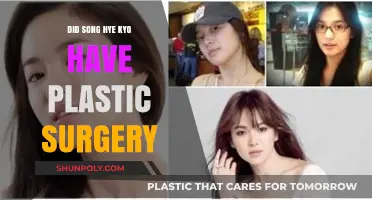 Song Hye Kyo Plastic Surgery: Unraveling the Truth Behind the Rumors
