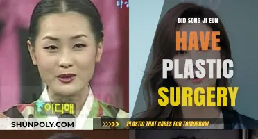Song Ji Eun's Transformation: Plastic Surgery Rumors Explored