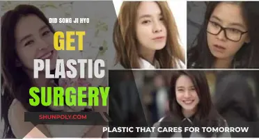 Song Ji Hyo Plastic Surgery: Fact or Fiction?