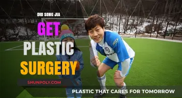 Song Jia's Transformation: Plastic Surgery Rumors Explored and Debunked