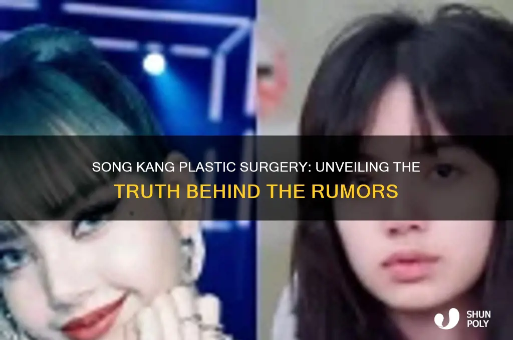 did song kang do plastic surgery
