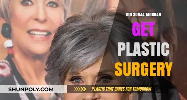 Sonja Morgan's Transformation: Plastic Surgery Rumors and Realities