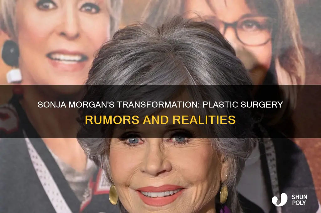 did sonja morgan get plastic surgery