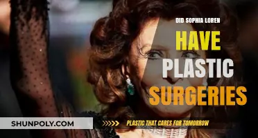 Sophia Loren's Beauty Secrets: Plastic Surgery Rumors Explored