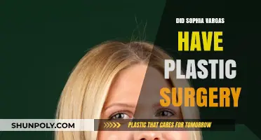 Sophia Vargas Plastic Surgery: Fact-Checking the Rumors and Speculations
