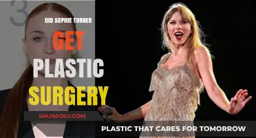 Sophie Turner Plastic Surgery: Fact-Checking the Rumors and Speculations