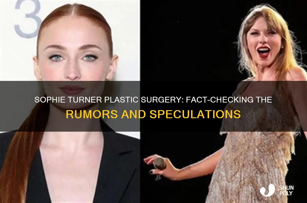 did sophie turner get plastic surgery
