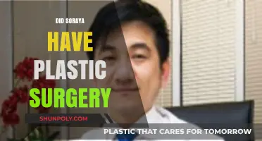 Soraya's Transformation: Unveiling the Truth About Plastic Surgery Rumors