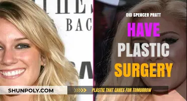 Spencer Pratt's Transformation: Plastic Surgery Rumors Explored