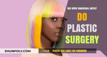 Spice Dancehall Artist Plastic Surgery: Fact or Fiction?
