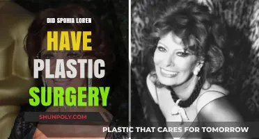 Sophia Loren's Ageless Beauty: Plastic Surgery Speculations Explored