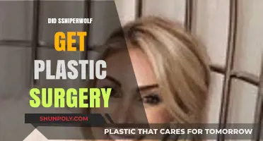 Did SSNiperWolf Undergo Plastic Surgery? Unveiling the Truth