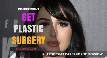 Did SSSniperWolf Undergo Plastic Surgery? Uncovering the Truth
