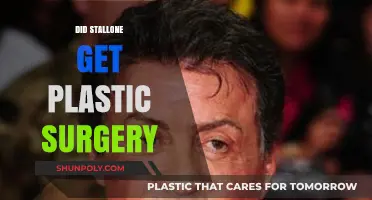 Did Stallone Undergo Plastic Surgery? Unveiling the Truth Behind His Look
