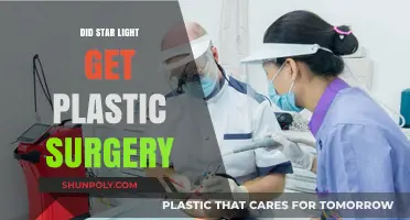 Did Star Light Undergo Plastic Surgery? Unveiling the Truth