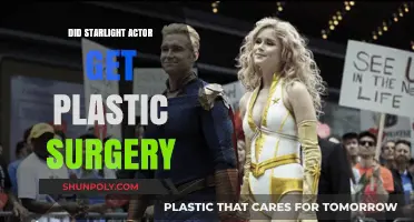 Did Starlight Actor Undergo Plastic Surgery? Unveiling the Truth