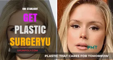 Did Starlight Undergo Plastic Surgery? Unveiling the Truth Behind the Rumors