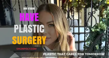 Stassi Schroeder's Transformation: Plastic Surgery Rumors and Realities