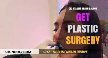 Stassie Karanikolaou's Transformation: Plastic Surgery Rumors Explored