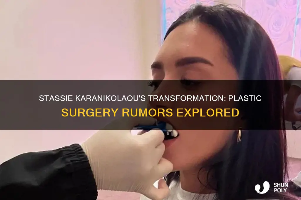 did stassie karanikolaou get plastic surgery