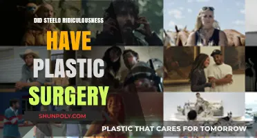Steelo Brim's Transformation: Plastic Surgery Rumors on Ridiculousness