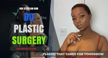 Stefflon Don's Transformation: Plastic Surgery Rumors Explored