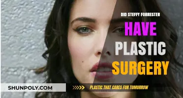Steffy Forrester's Transformation: Plastic Surgery Rumors Explored