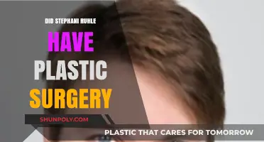 Stefani Ruhle's Transformation: Plastic Surgery Speculations and Facts