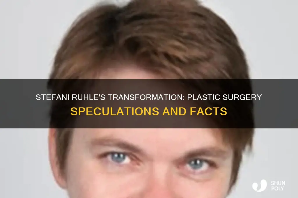 did stephani ruhle have plastic surgery
