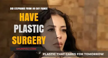 Stephanie's Transformation: Plastic Surgery Rumors on 90 Day Fiancé