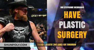 Stephanie McMahon's Transformation: Plastic Surgery Speculations and Truths