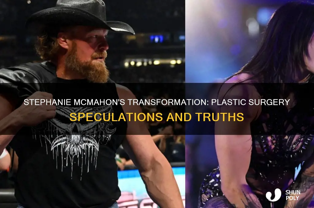 did stephanie mcmahon have plastic surgery