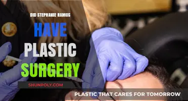 Stephanie Ramos Plastic Surgery: Fact-Checking the Rumors and Speculations