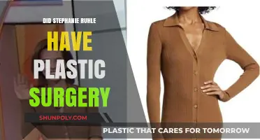 Stephanie Ruhle's Transformation: Plastic Surgery Speculations and Facts Revealed
