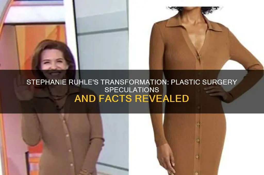 did stephanie ruhle have plastic surgery