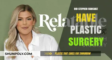 Stephen Bancarz Plastic Surgery: Fact-Checking the Transformation Rumors