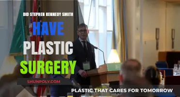 Stephen Kennedy Smith Plastic Surgery: Fact or Fiction?
