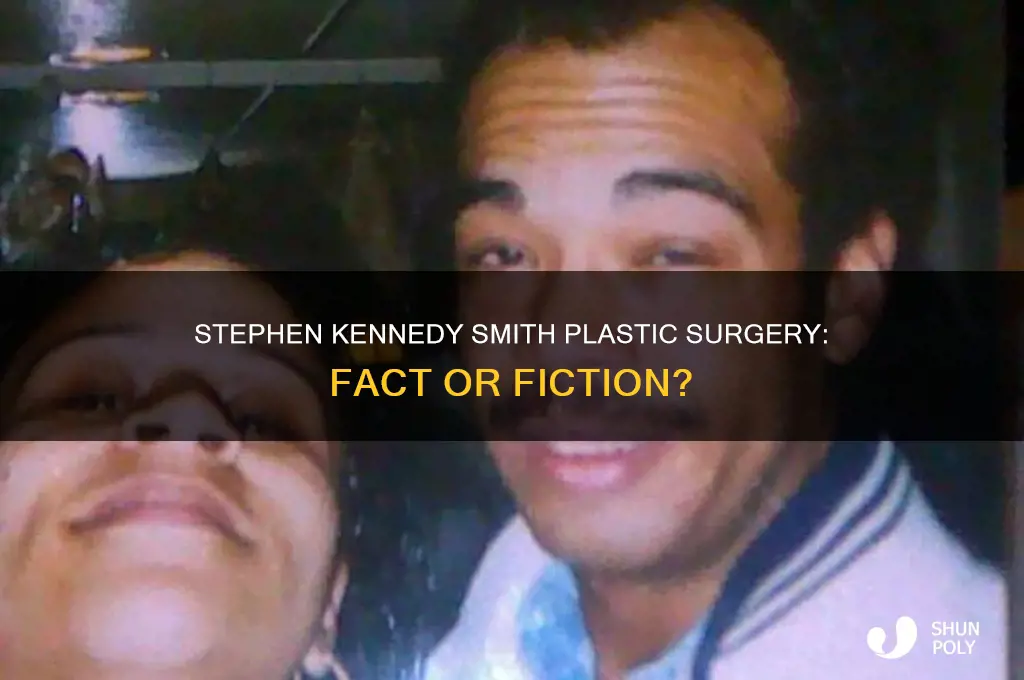 did stephen kennedy smith have plastic surgery