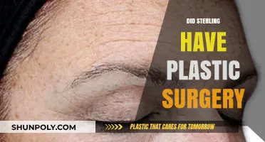 Sterling's Transformation: Plastic Surgery Rumors and the Truth Behind Them