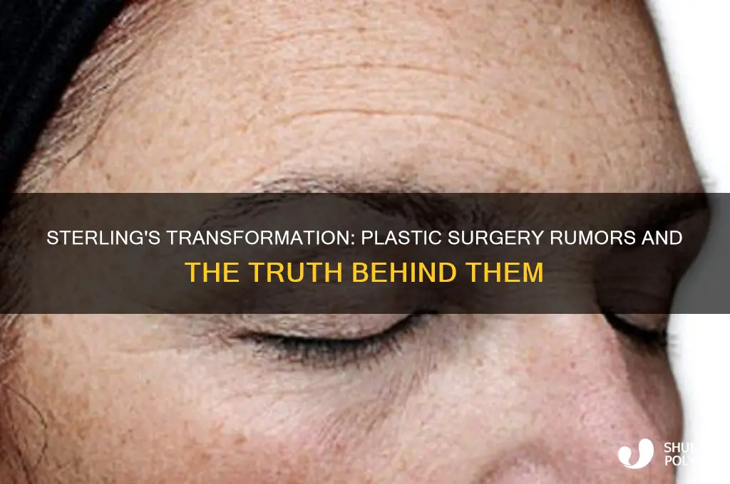 did sterling have plastic surgery