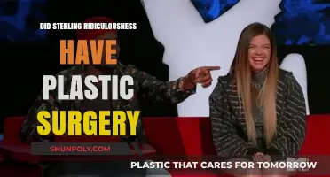 Sterling Ridiculousness Plastic Surgery: Fact-Checking the Transformation Rumors