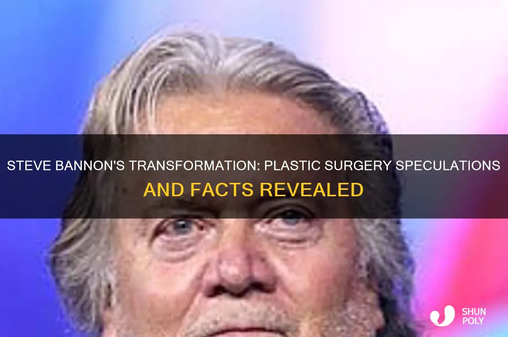 did steve bannon have plastic surgery