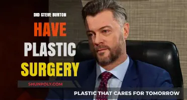 Steve Burton's Transformation: Plastic Surgery Speculations and Truths