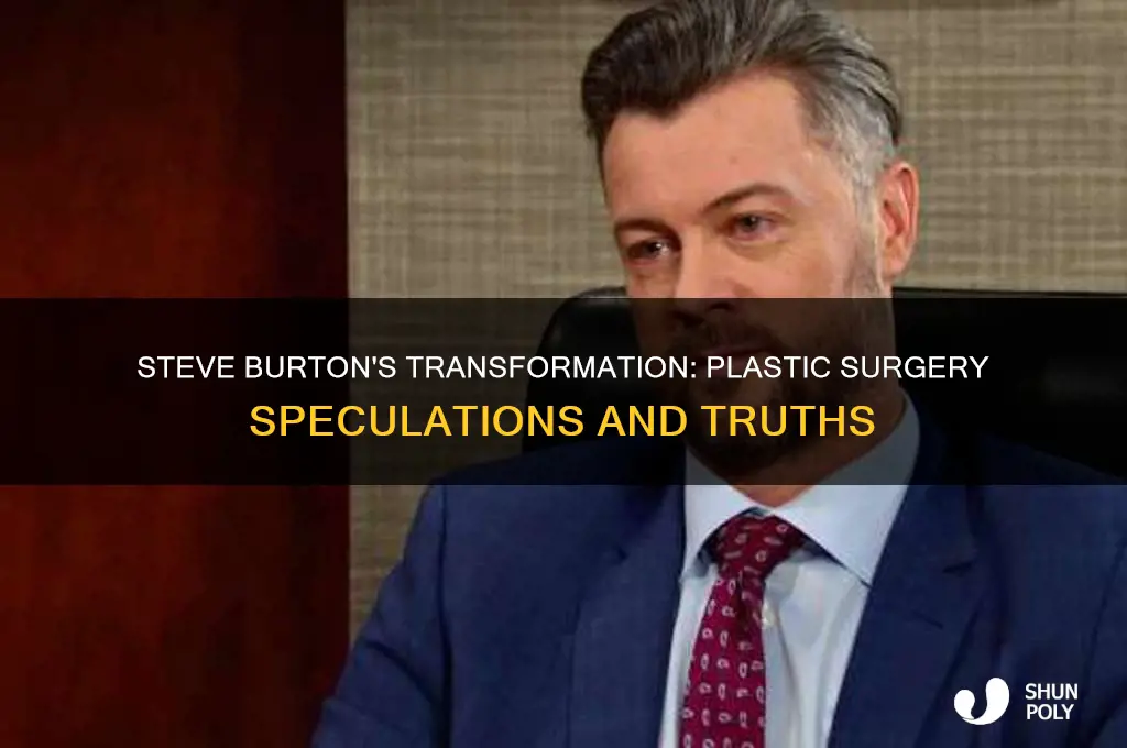 did steve burton have plastic surgery