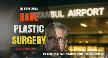 Steve Carell's Transformation: Plastic Surgery Rumors Explored and Debunked